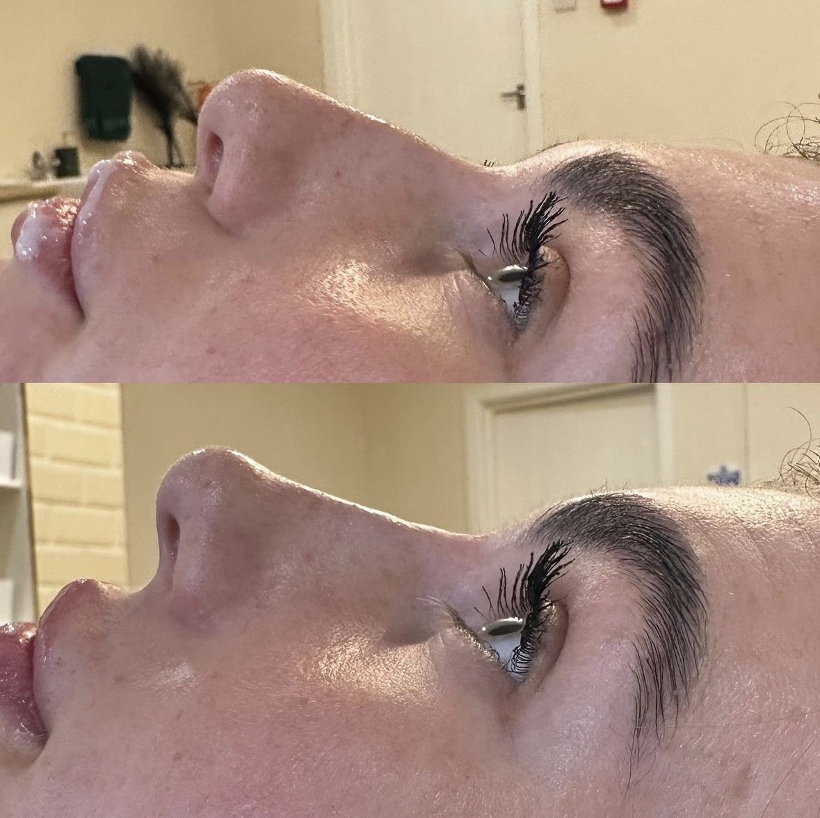 VIP Tailored Mastery Refresher day for Aesthetics and business (Practical)