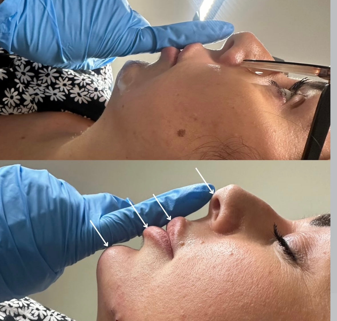 The Non Surgical Facelift & 8 Point Lift Mastery Experience (Practical)