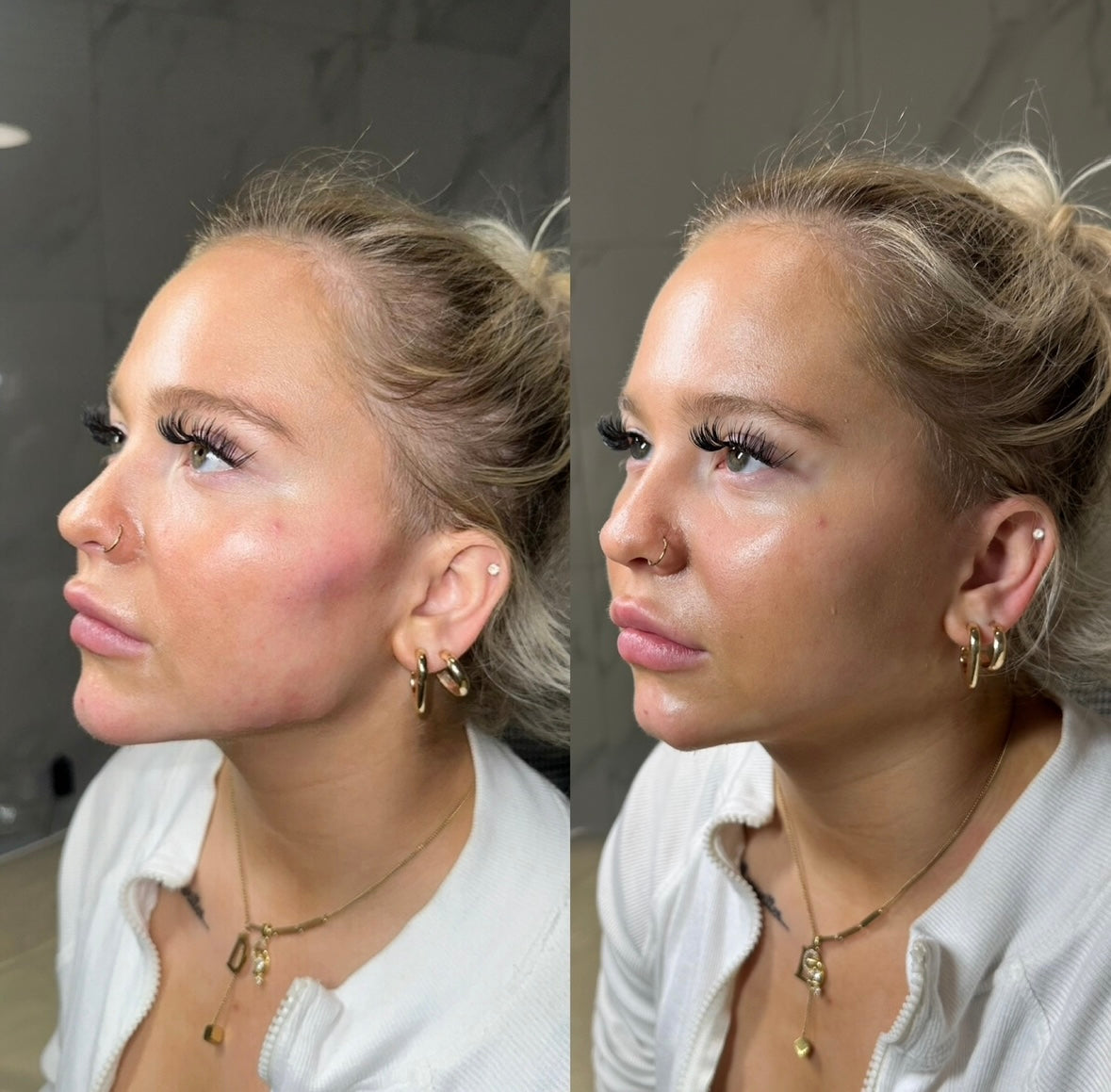 The Non Surgical Facelift & 8 Point Lift Mastery Experience (Practical)