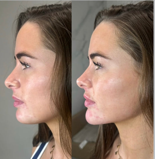 The Non Surgical Facelift & 8 Point Lift Mastery Experience (Practical)