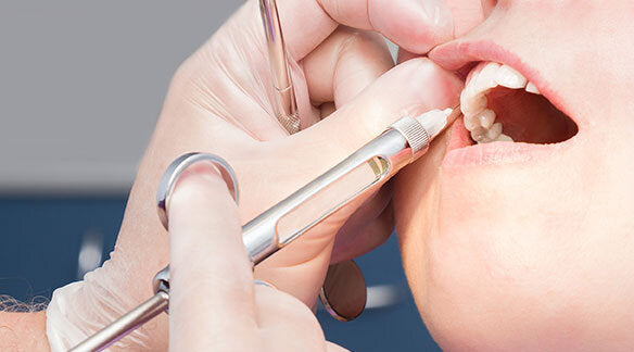 Dental Block Training (Online)